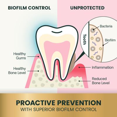 Perio Plus Healthy Mouth Chicken Flavored Dental Chews, 30 count