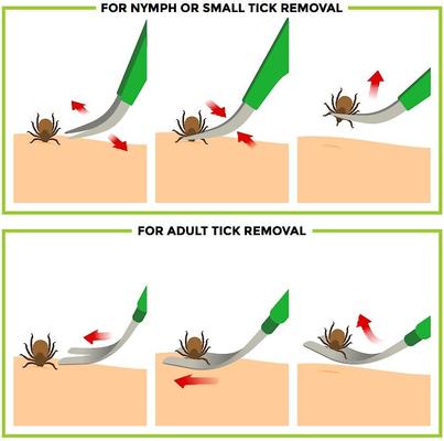 Premium Dog Tick Removal Kit