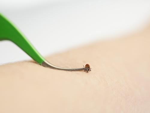 Premium Dog Tick Removal Kit